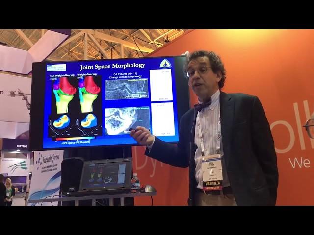 Dr. Schon on Weight-Bearing Imaging at American Academy of Orthopaedic Surgeons 2018 Annual Meeting