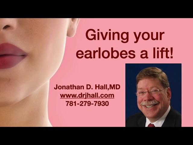 Giving Your Earlobes a Lift!