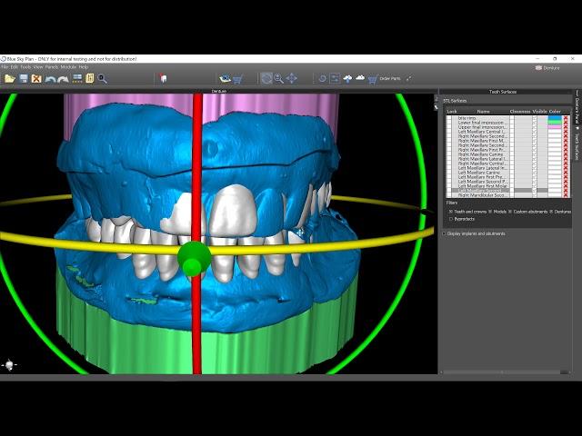 Blue Sky Bio Denture Software Beta Tutorial