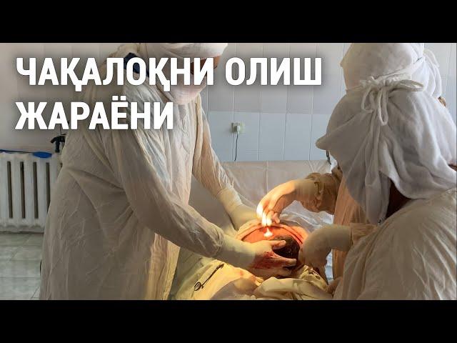 Кесар кесиш: болани олиш жараёни