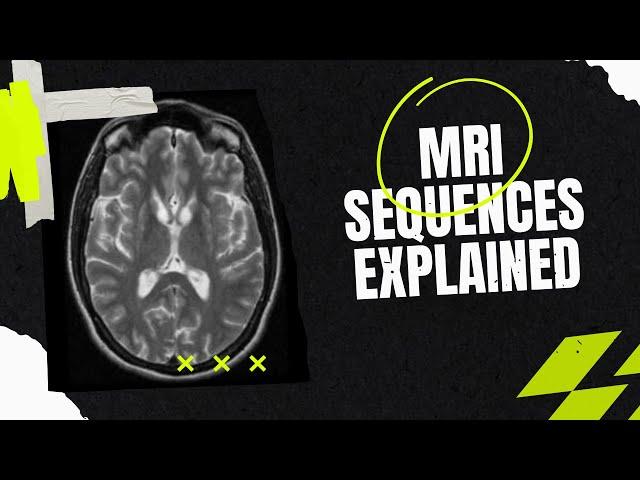 MRI sequences- How to identify , the easy way? For medical students, residents, clinicians.