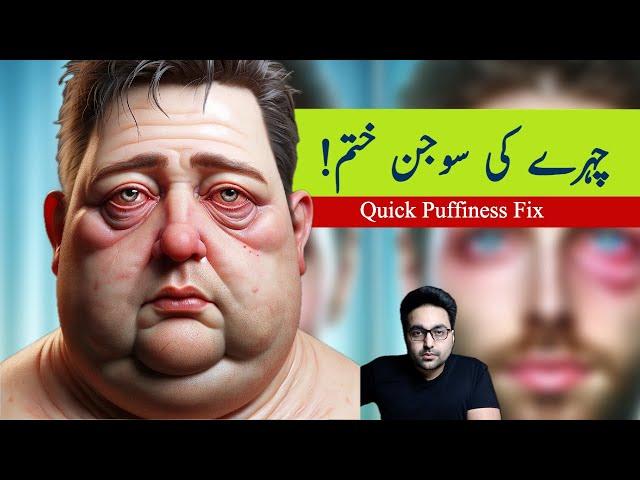 Dr. Zee:Easiest Way to Fix the Swollen Face (Facial Puffiness) and Puffy Eyes  | डॉक्टर ज़ी