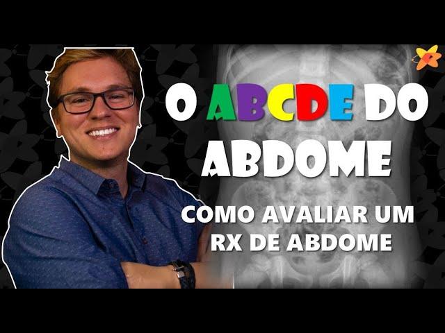 COMO AVALIAR RAIO X ABDOME ? O ABCDE DO ABDOME I VOCÊ RADIOLOGISTA