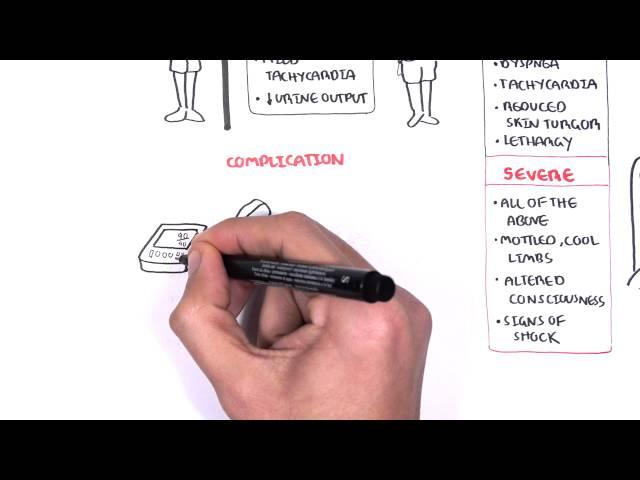 Acute Gastroenteritis (Paediatrics) Overview