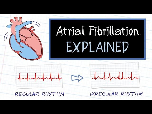 What is Atrial Fibrillation?