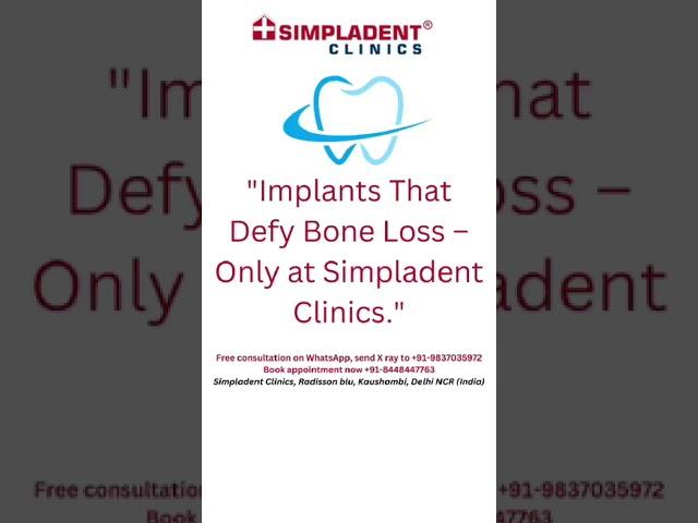 Implants That Defy Bone Loss Only At Simpladent Clinics | Dental Implants #boneloss #dentalclinic