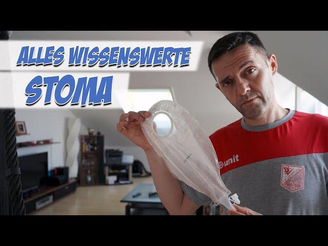 Stoma | Wissenswerte | Pflege Kanal