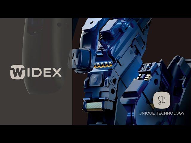 Widex Difference- Unique Technology | WIDEX hearing aids