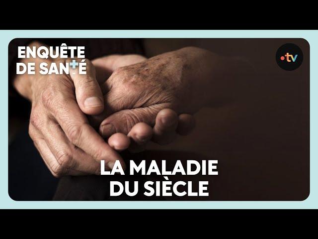 Maladie d'Alzheimer, mal comprise et incurable