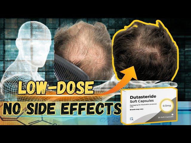 Low-Dose Dutasteride is Safer Than Finasteride