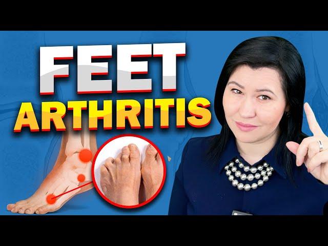 5 Causes for Feet Arthritis -A Rheumatologist Perspective