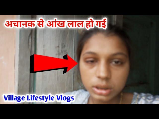 Akhon Me Conjunctivitis Hogya  | Shalu Rani Vlogs| #dailyvlogs