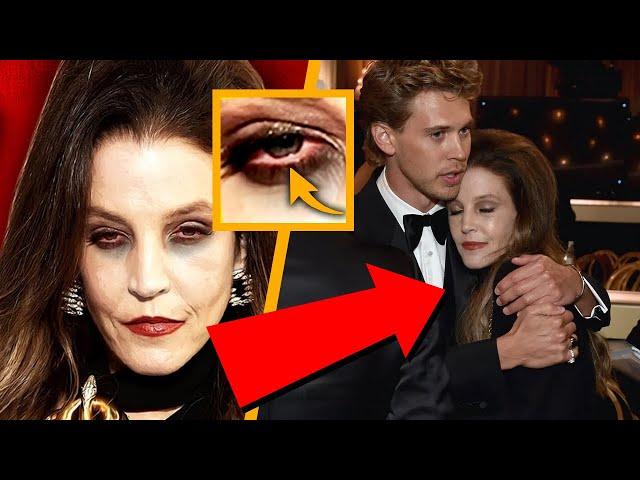 WARNING SIGNS for Lisa Marie Presley Prior to Her Passing at Golden Globe Awards