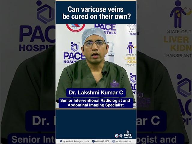 Can Varicose Veins be cured on their own? #Shorts | PACE Hospitals #Short #varicosevein