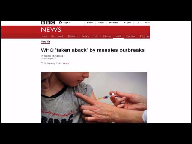 Measles and the MMR vaccine