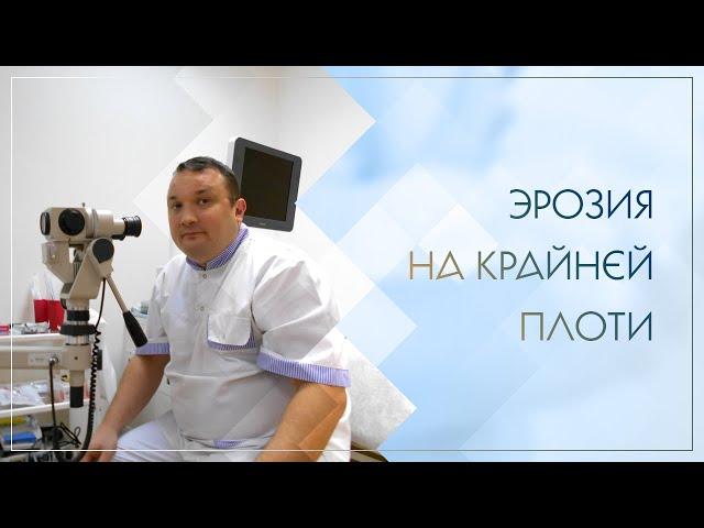  Эрозия на крайней плоти. Клинический случай №84