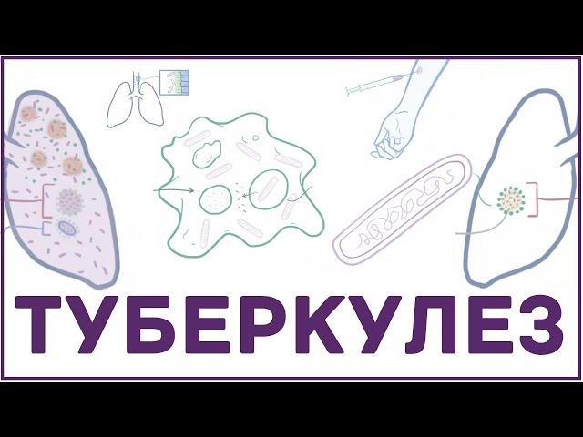 Туберкулез - микобактерия, симпмтомы, патофизиология, диагностика, лечение
