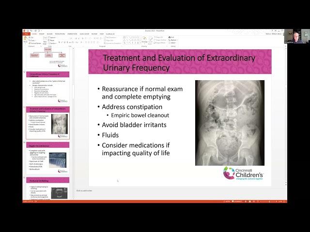 IVUmed VVP: Pediatric Enuresis