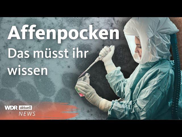 Affenpocken in Deutschland: Das wissen wir bisher | Aktuelle Stunde