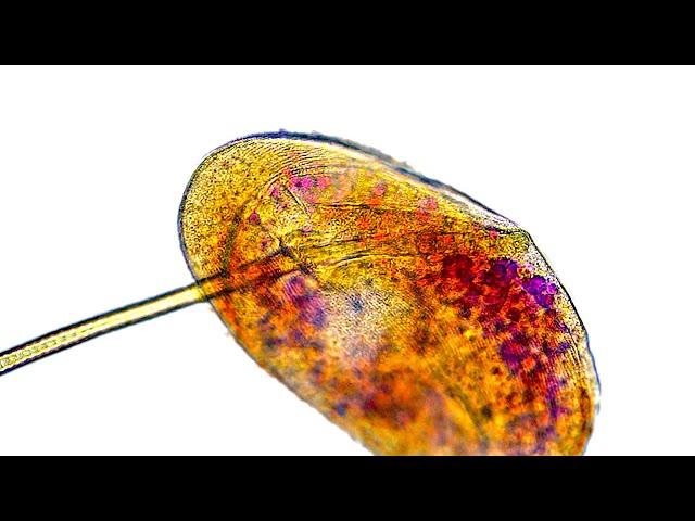 How do microbes eat? Chlamydodon feeding on Cyanobacteria