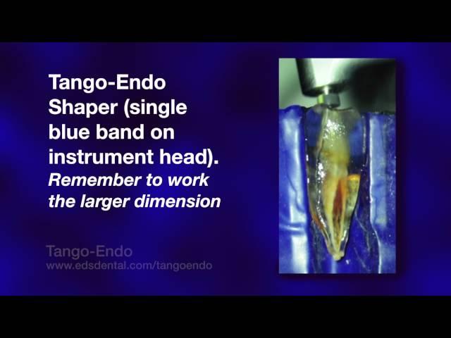 Tango-Endo Instrumentation: Completed in a plastic tooth for viewing