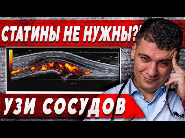 НУЖНЫ ЛИ СТАТИНЫ?! УЗНАЙ ПО УЗИ СОСУДОВ ШЕИ - БРАХИОЦЕФАЛЬНЫХ АРТЕРИЙ!