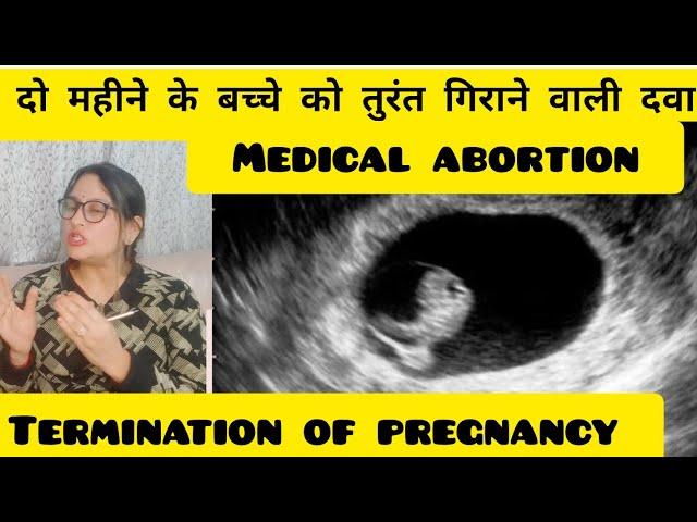 दो महीने के बच्चे को तुरंत गिराने वाली दवा |Abortion pills lene k baad bleeding kab shuru Hoti hai .