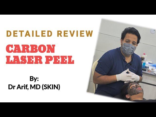 CARBON LASER PEEL/ LASER TREATMENT By Dermatologist ​⁠@DrArifMDDermatologist #carbonlaserpeel