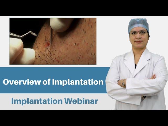 Overview of Implantation | Implantation Webinar | Dr. Seema Garg | Indore | AHRS - INDIA