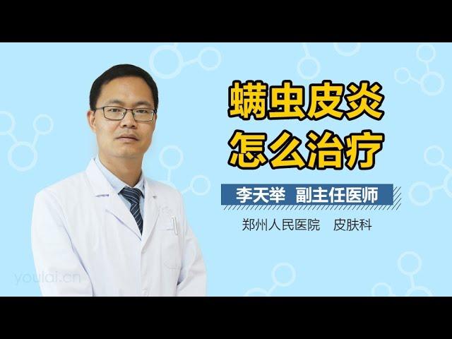 螨虫皮炎怎么治疗 有来医生