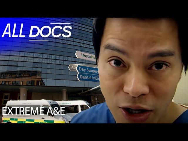 Kings College Hospital in London | S01 E03 | Medical Documentary | All Documentary