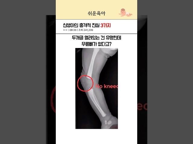 신생아에 대한 놀라운 사실 3가지