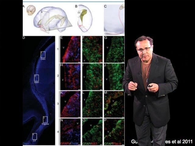 Alfredo Quiñones-Hinojosa (Johns Hopkins) Part 2: Stem Cells and Brain Tumors