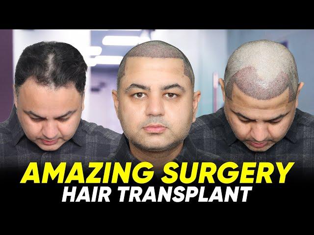 Hair Transplant in Indore | Best Results & Cost of Hair Transplant in Indore