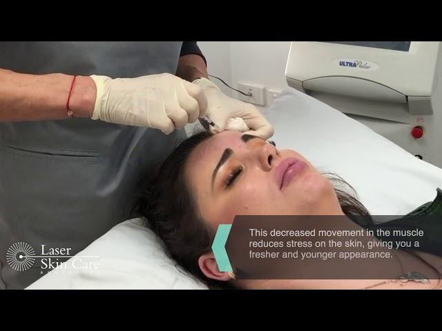 Wrinkle Relaxer Treatment at Laser Skin Care