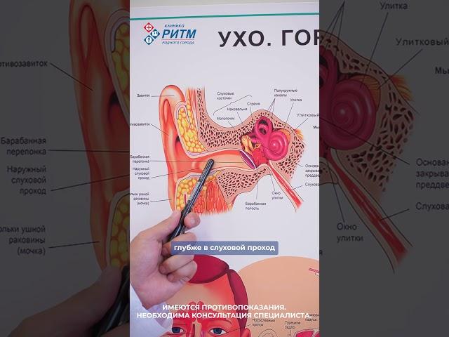 Почему нельзя чистить уши ватными палочками? #лорврач #уланудэ #медицина  #ватныепалочки