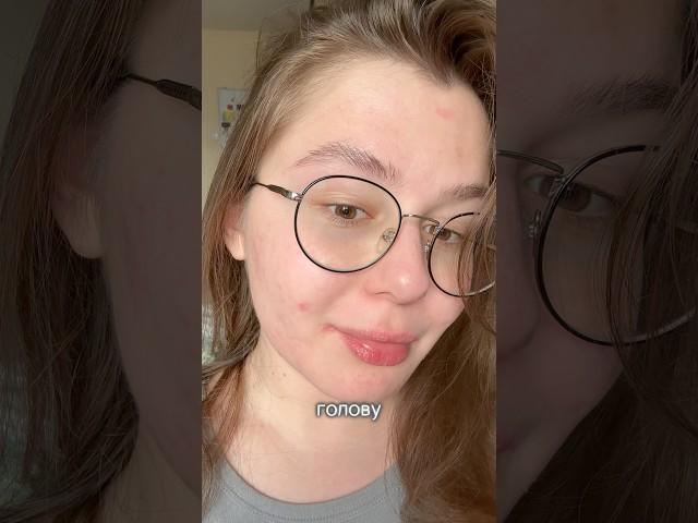 РЕТИНОИДЫ ИЗМЕНИЛИ ЖИЗНЬ 🫣#акне #лечение #кожа #макияж #красота
