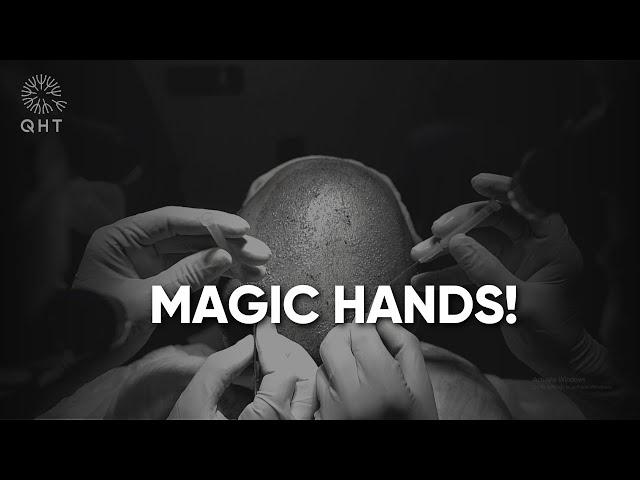 Magic Hands at QHT Clinic Haridwar | Best Hair Transplant Result In India | QHT Clinic