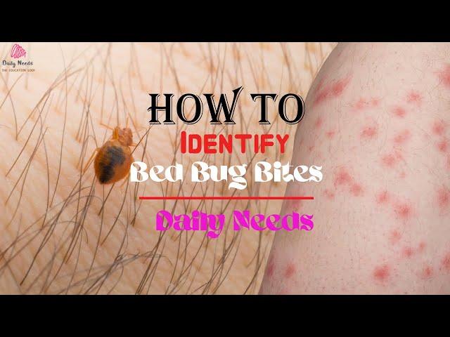 How to Identify Bed Bug Bites | Daily Needs Studio