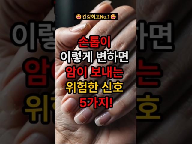 손톱이 이렇게 변하면 암이 보내는 위험한 신호 5가지! ##건강 #건강정보 #건강관리