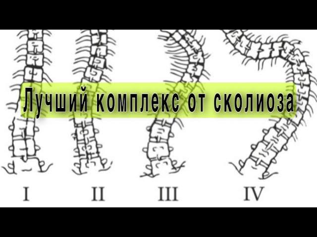 Полный комплекс при сколиозе любой степени.