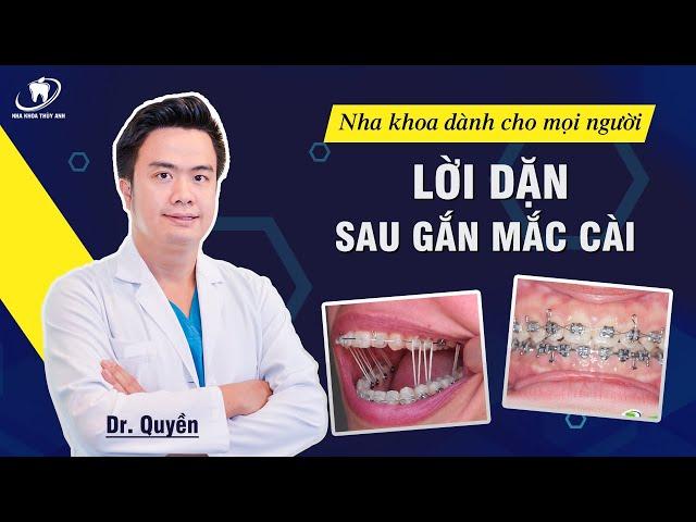 Lời dặn sau khi gắn mắc cài niềng răng