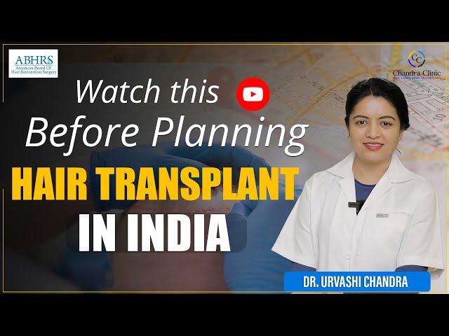 Are You Planning Hair Transplant Surgery? | Hair Transplant Surgery in India | Chandra Hair Clinic