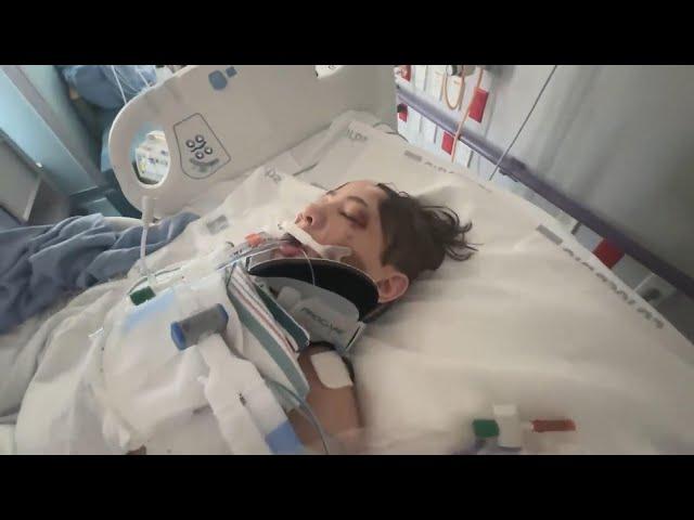 Teen YouTuber Nidal Wonder Recovering After Scooter Accident