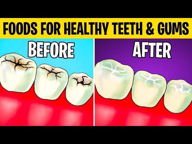 7 Foods For Healthy Teeth & Gums