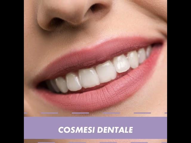 Faccette estetiche dentali