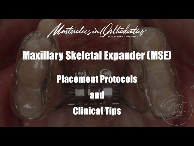 Maxillary Skeletal Expander | MSE | Jaw Expansion | Placement Procedure | Clinical Protocol and Tips