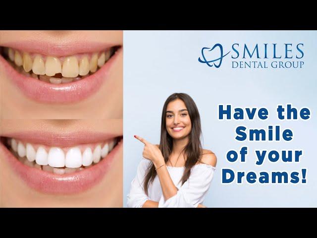 How to transform your Smile with Cosmetic Dentistry (2021)