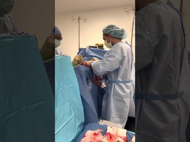 Dr.Repta Performs A Plus Size Tummy Tuck (Graphic Content)