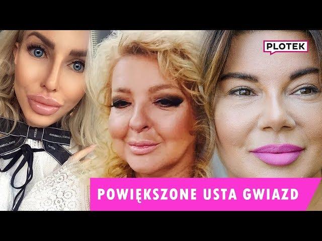 NASZE TOP 10 - powiększone usta gwiazd